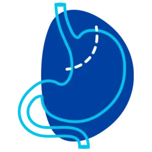 angel-romero-cirujano-bypass