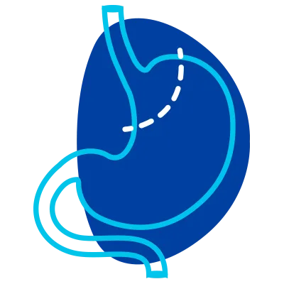 angel-romero-cirujano-bypass